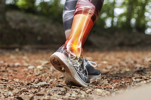 Nahaufnahme Unterschenkel Joggerin im Wald